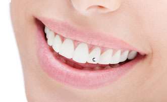 Zähne mit stilvollem Zahnschmuck - Einzigartige Zahnästhetik